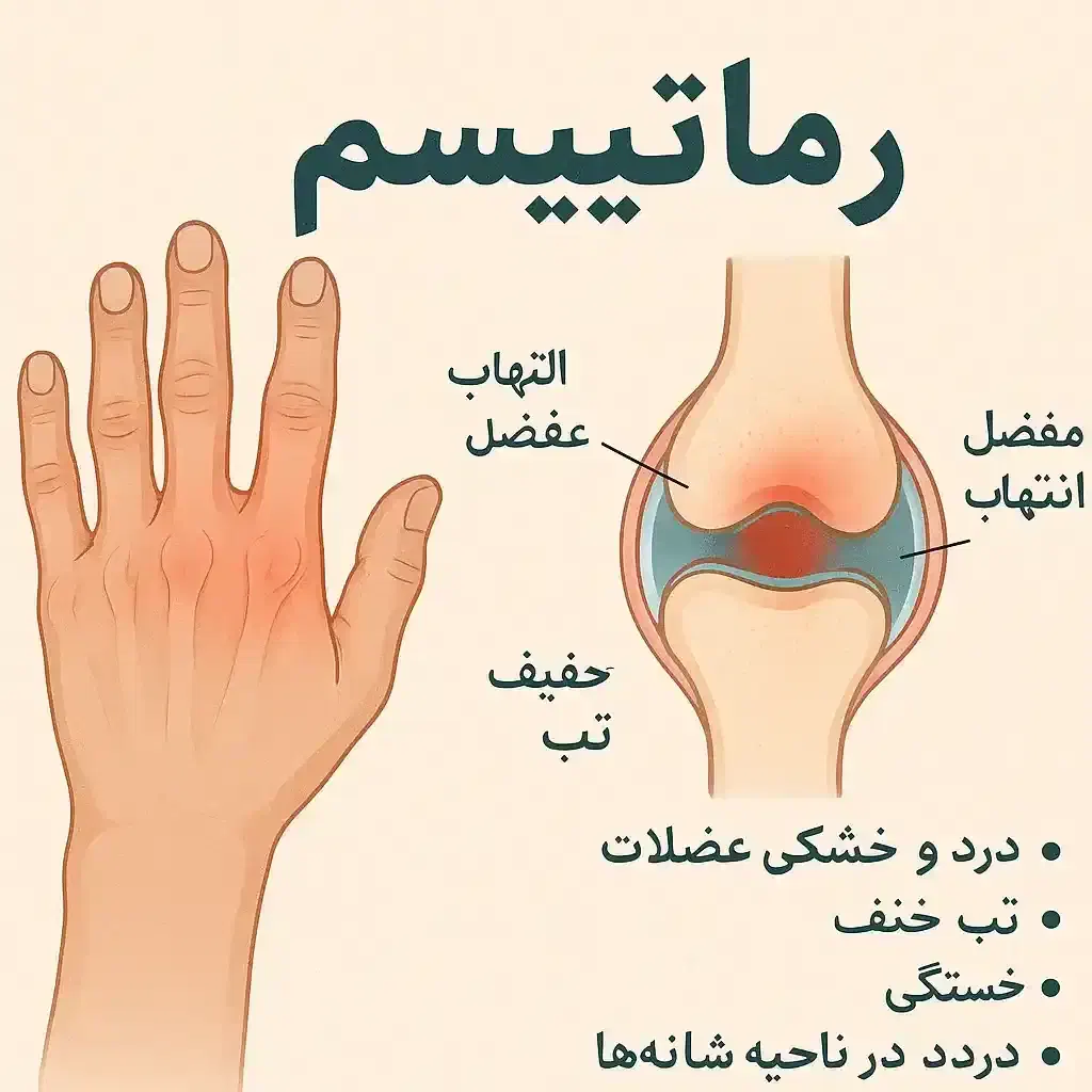 از رماتیسم درد کمر و پا خسته شدی|آرایشی، بهداشتی، درمانی|تبریز, |دیوار