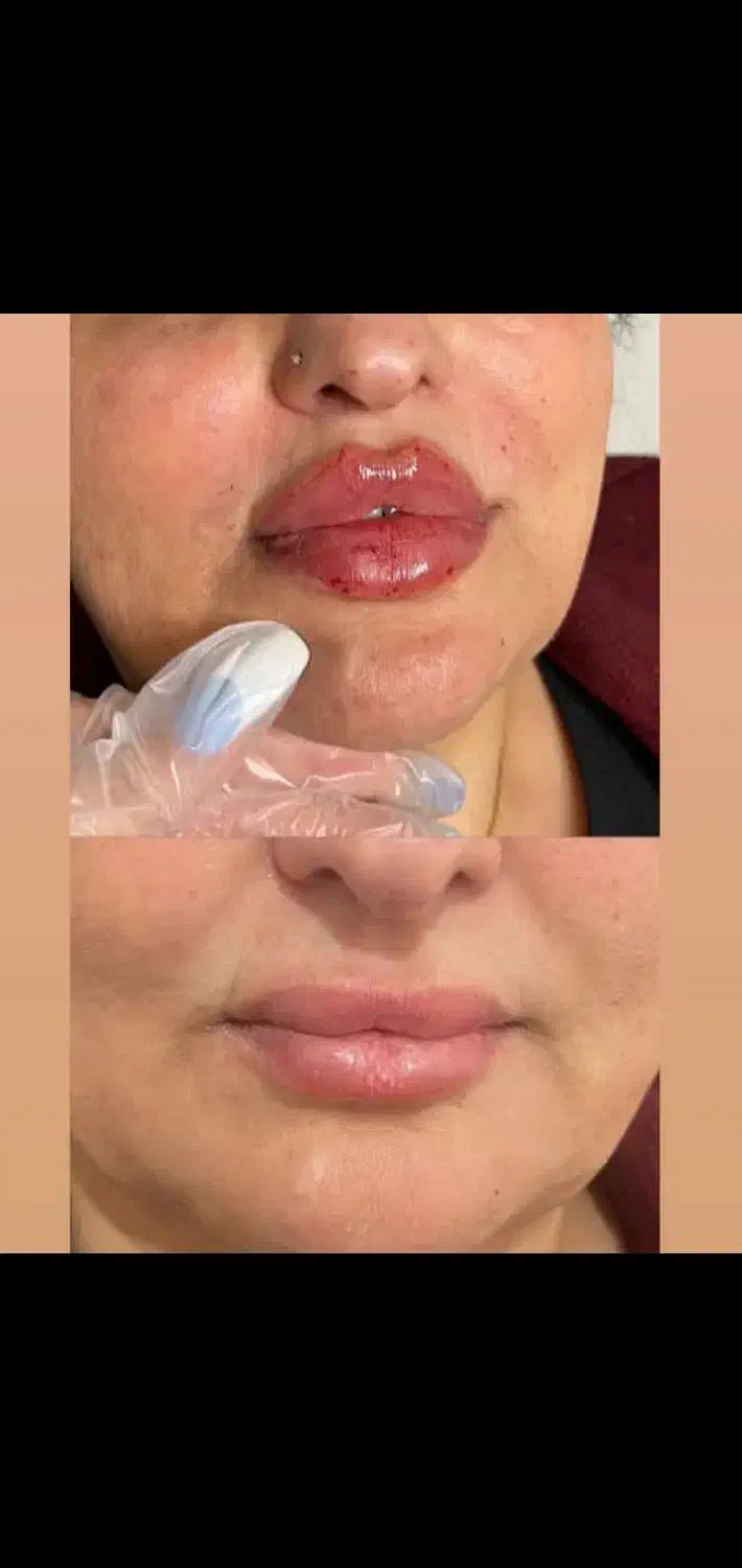 آف یلدایی ژل و بوتاکس|خدمات آرایشگری و زیبایی|دورود, |دیوار