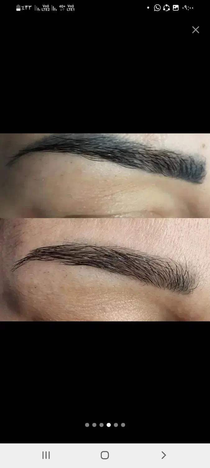 ریموور تخصصی  تاتو با مواد اصل آمریکایی با ضمانت|خدمات آرایشگری و زیبایی|جیرفت, |دیوار