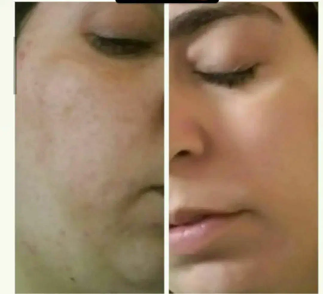 پاکسازی فوری کبد ولاغری با محصولات طبیعی|آرایشی، بهداشتی، درمانی|تربتحیدریه, رضاشهر|دیوار