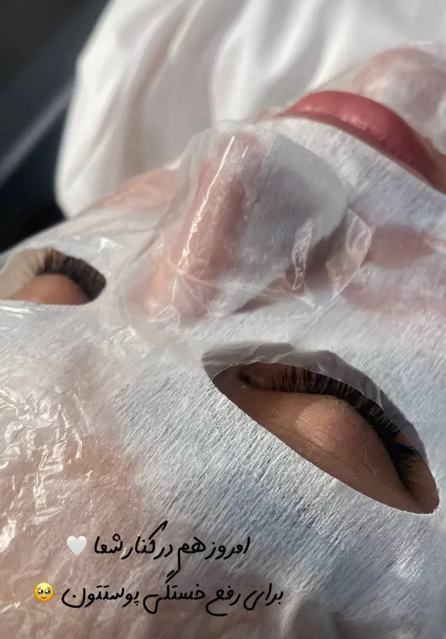 لیزر|خدمات آرایشگری و زیبایی|کرمانشاه, |دیوار