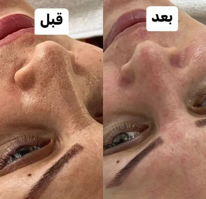 فیشیال|خدمات آرایشگری و زیبایی|زرند, |دیوار