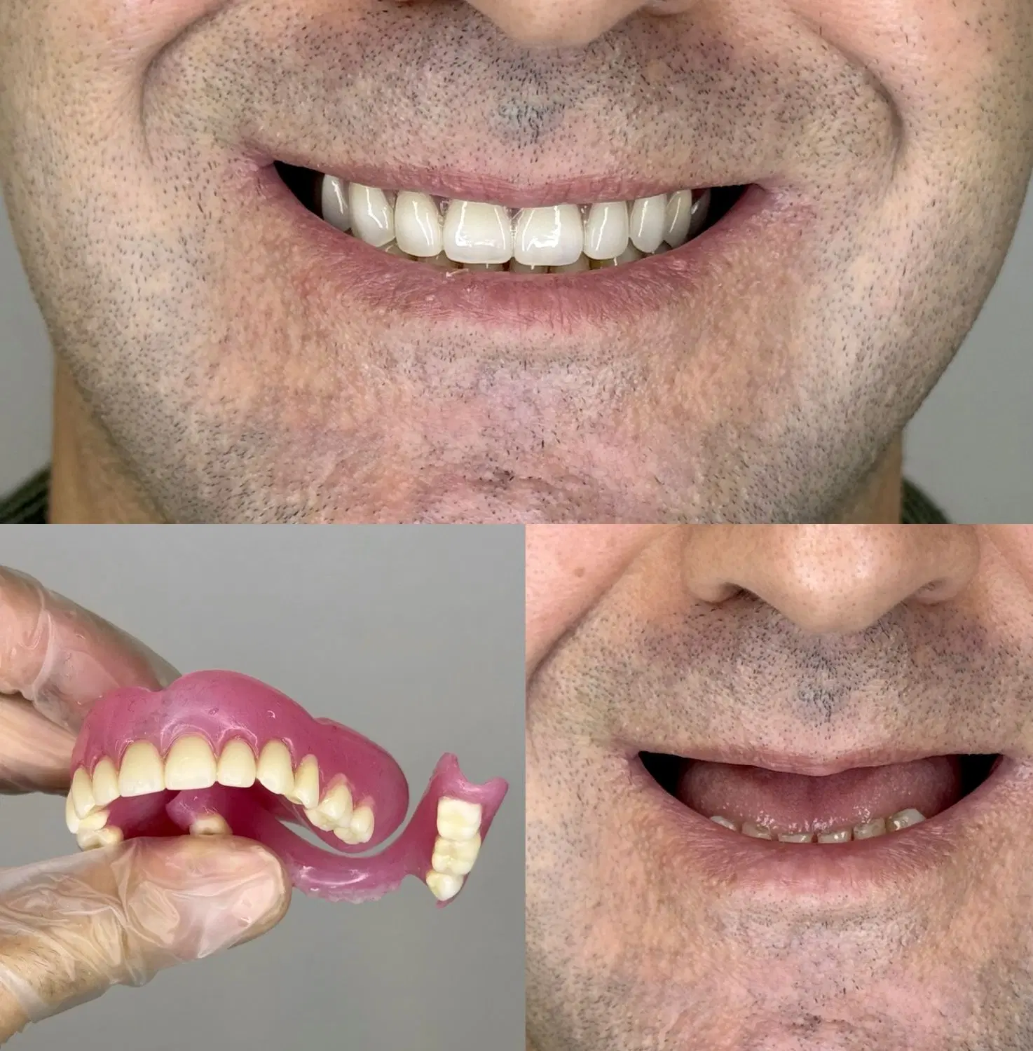 دندان مصنوعی + لابراتوار دندانسازی با گارانتی|خدمات زیبایی و سلامت|تهران, شهرک ولیعصر جنوبی|دیوار
