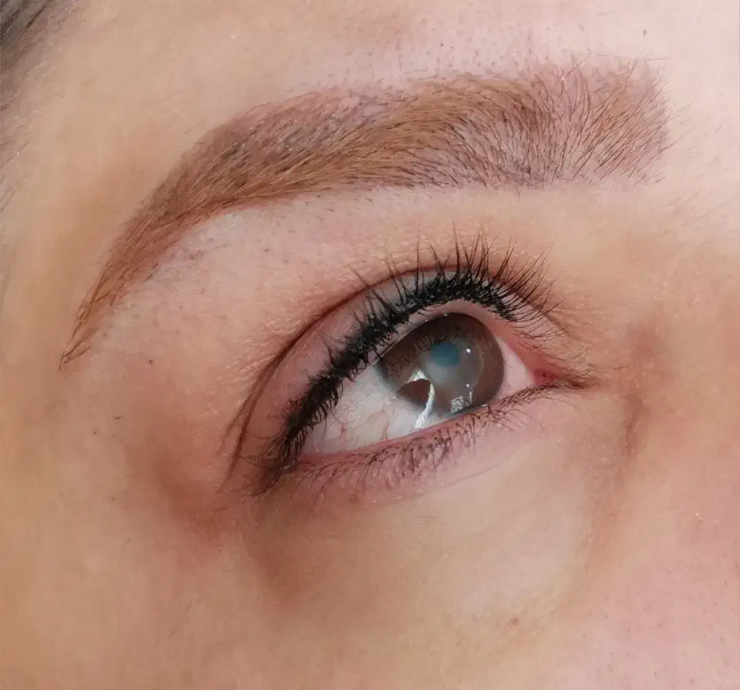 مدل برای فیبروز و خاویار تراپی|خدمات آرایشگری و زیبایی|اردبیل, |دیوار