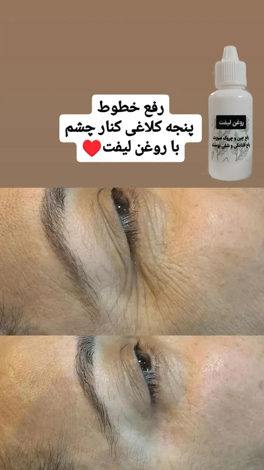 روغن رفع چین چروک|آرایشی، بهداشتی، درمانی|حمیدیا, |دیوار