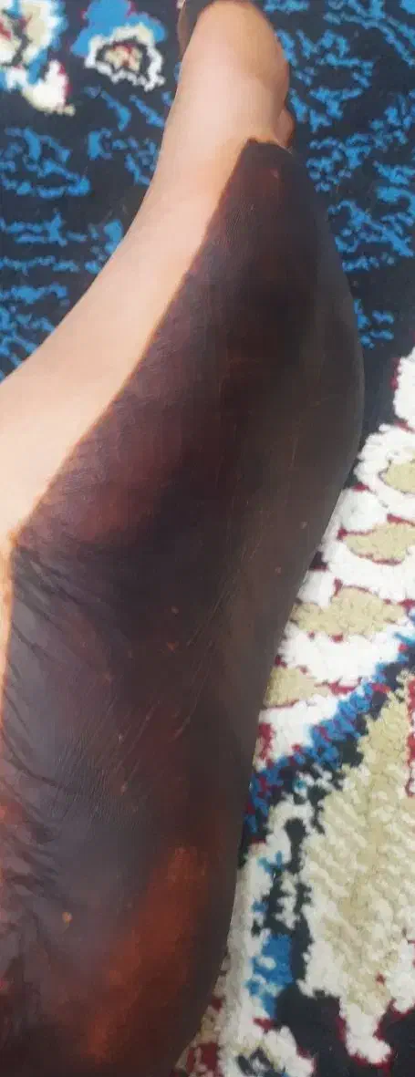 پرس لباس .چادر وغیره .فروش حنا لقمه ای ومعصار|صنایع دستی و سایر لوازم تزئینی|قشم, |دیوار