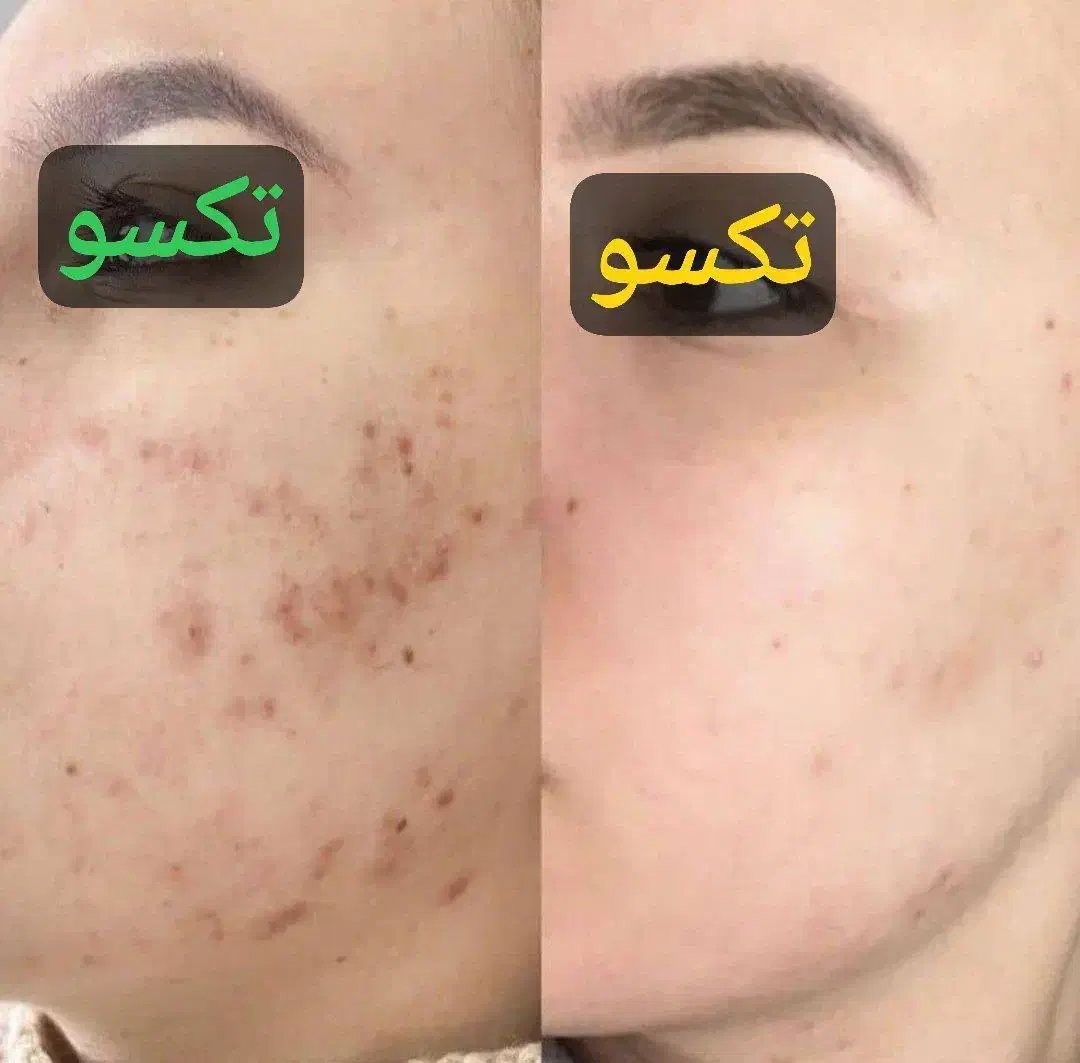 تناسب اندام و زیبایی|آرایشی، بهداشتی، درمانی|شیراز, حافظیه|دیوار