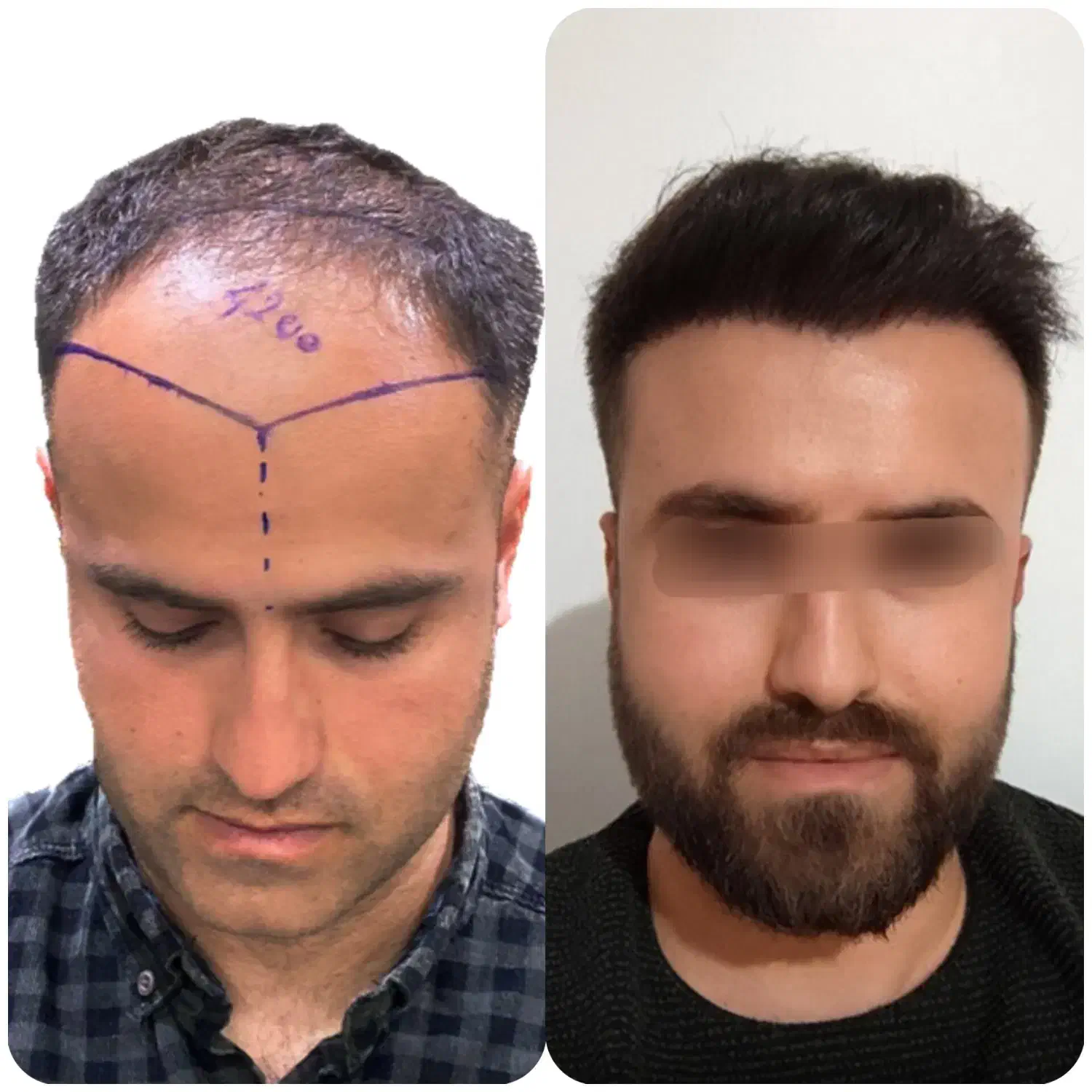 کاشتمو شیراز با شرایط اقساط|خدمات آرایشگری و زیبایی|شیراز, قدوسی شرقی|دیوار