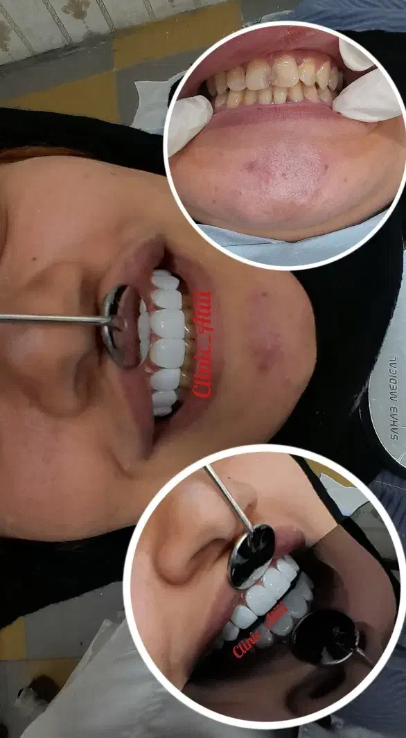 آموزش تخصصی کامپوزیت|خدمات آموزشی|اهواز, نادری|دیوار