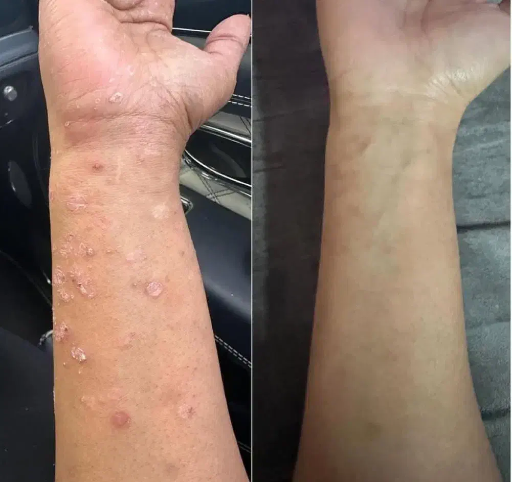 درمان مشکلات پوستی|آرایشی، بهداشتی، درمانی|جوانرود, |دیوار