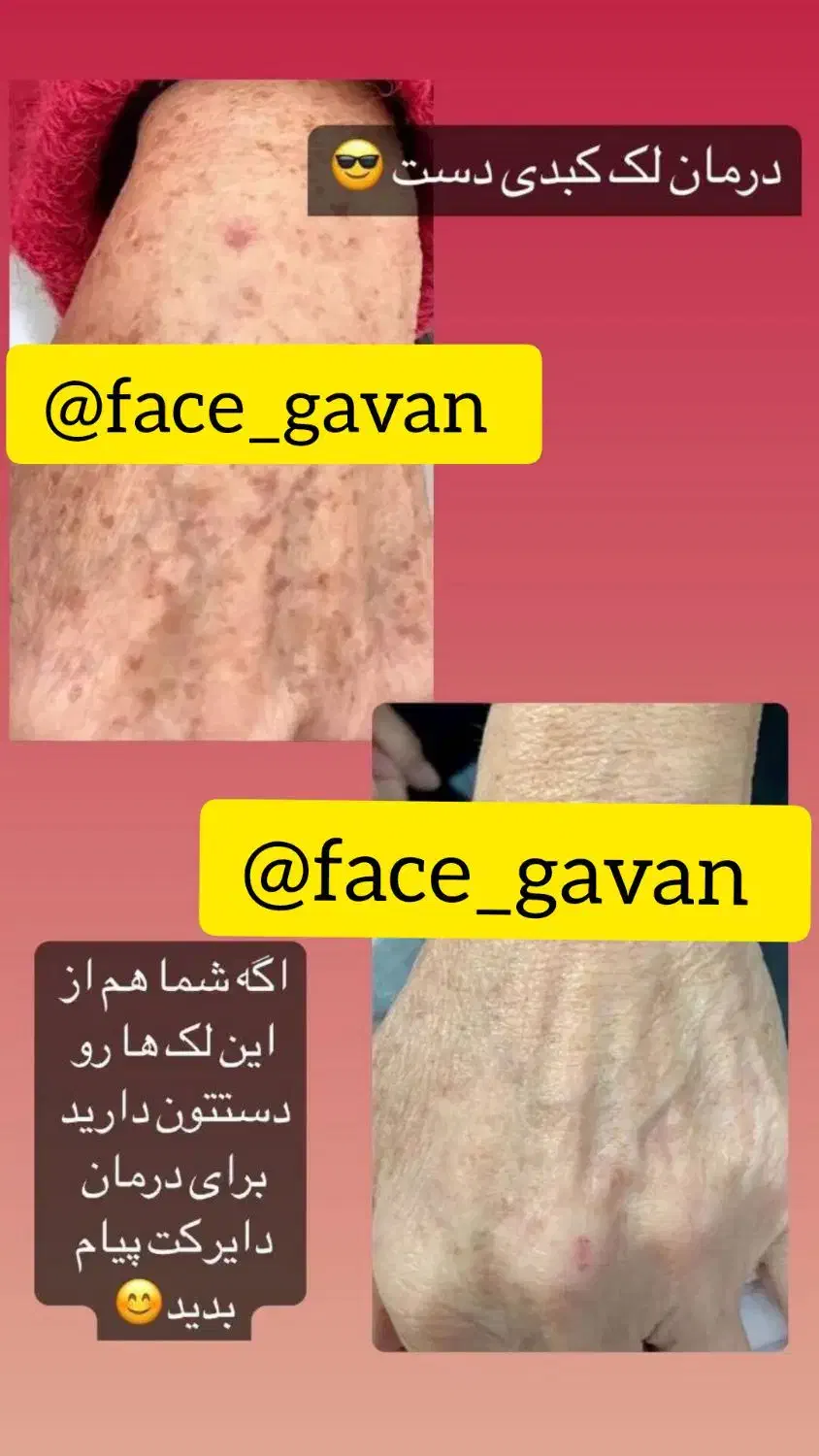 بزرگترین غول ۸کاره جهان|آرایشی، بهداشتی، درمانی|شیراز, کفترک|دیوار