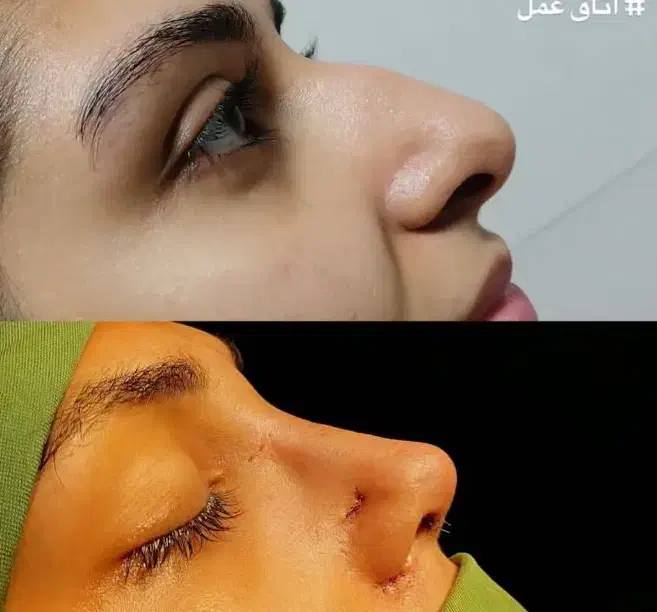 آفر ویژه عمل بینی /پلک /دندان/لیپوساکشن/غبغب|خدمات آرایشگری و زیبایی|شیراز, عفیف‌آباد|دیوار