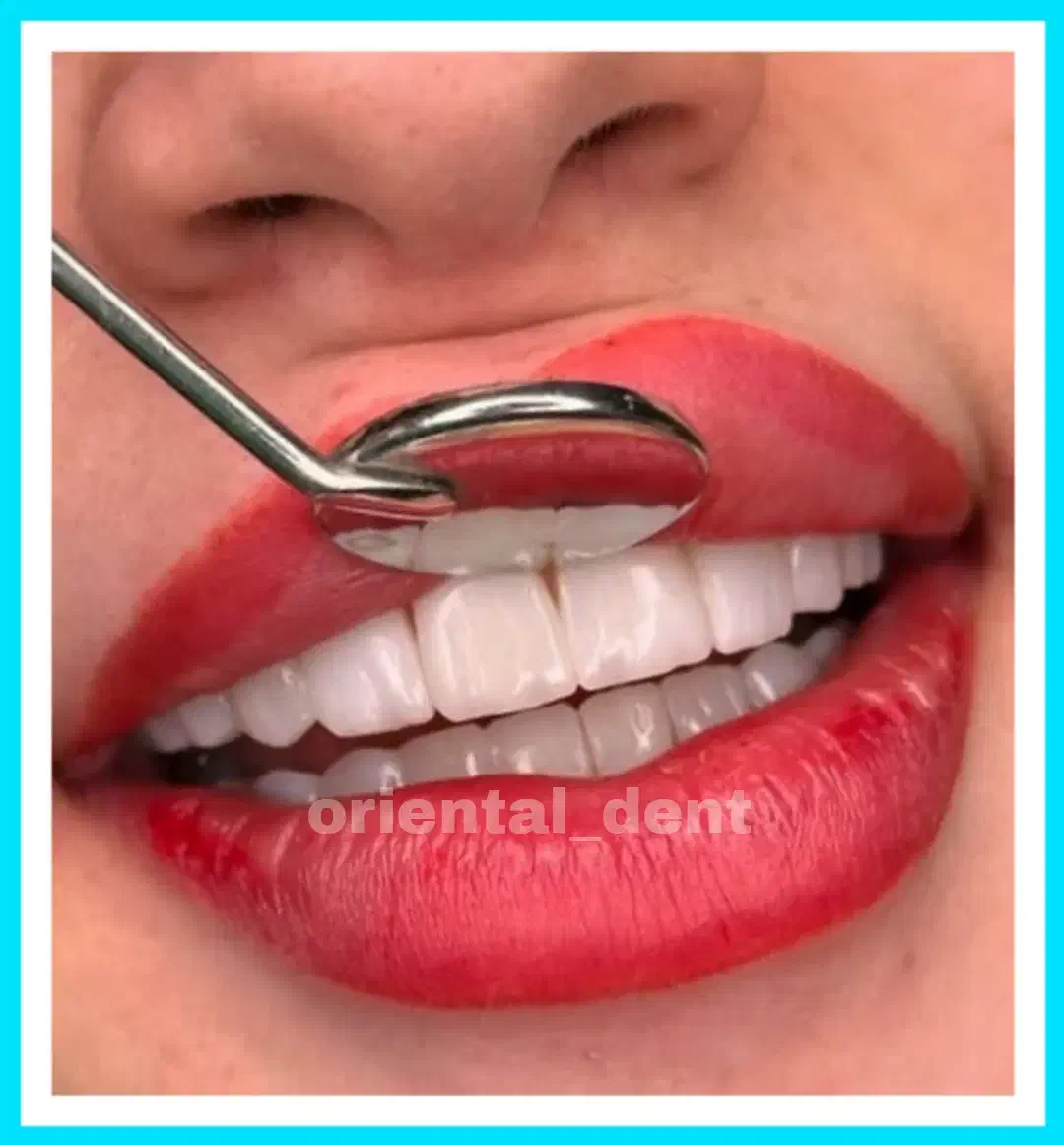 کامپوزیت دندان/ترمیم/دندانپزشکی/عصبکشی|خدمات آرایشگری و زیبایی|تهران, تهرانپارس شرقی|دیوار