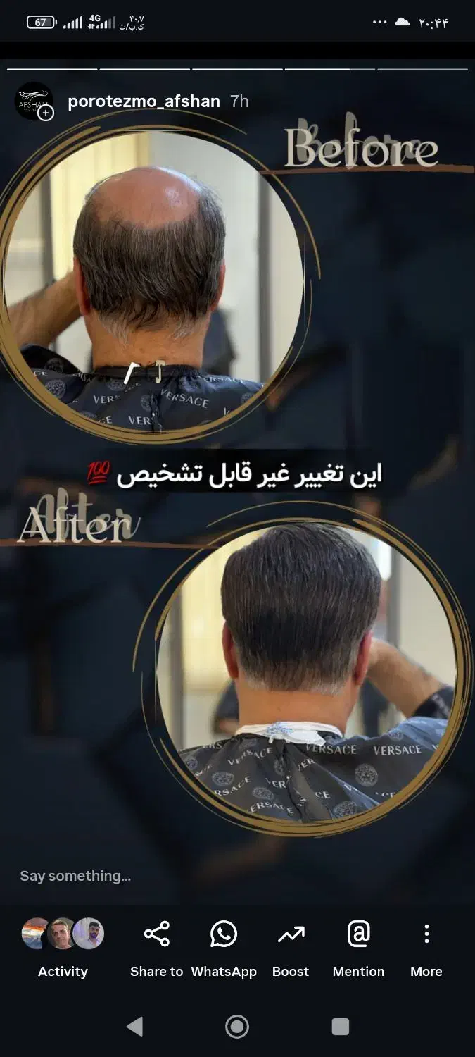 پروتز و ترمیم موی افشان|خدمات آرایشگری و زیبایی|مشهد, کوثر|دیوار