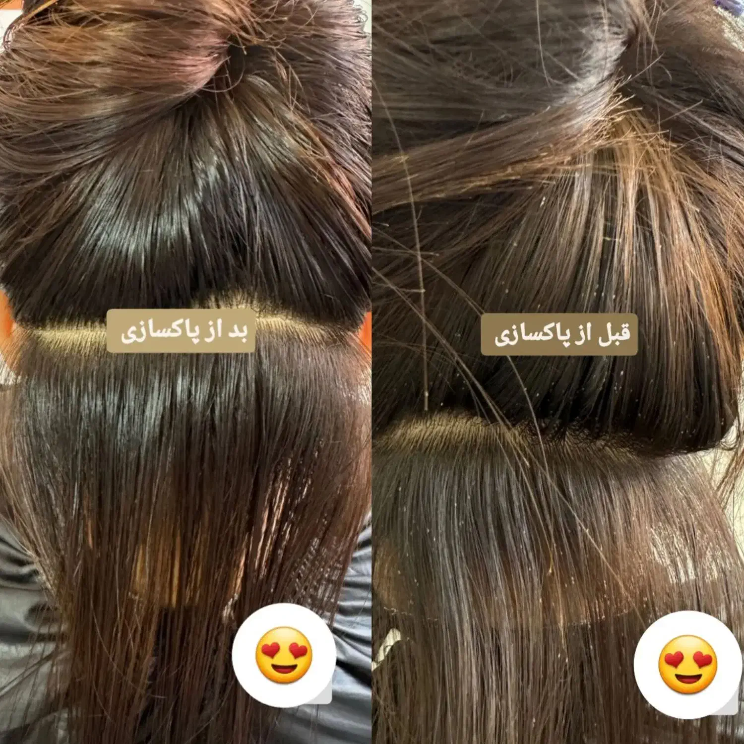 نیرو جهت کار در سالن پاکسازی شپش|استخدام درمانی، زیبایی، بهداشتی|قم, نیروگاه|دیوار
