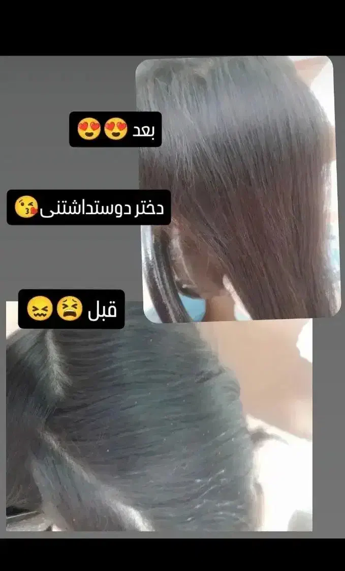 درمان قطعی و تضمینی رشک وشپش|آرایشی، بهداشتی، درمانی|قرق, |دیوار