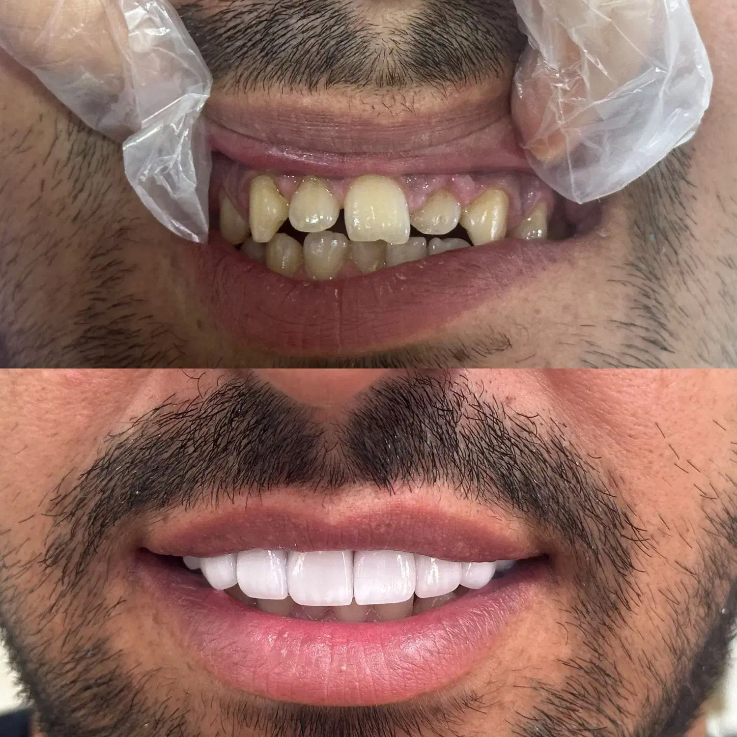 جشنواره دندانپزشکی (تمامی خدمات)|خدمات آرایشگری و زیبایی|اصفهان, لنبان|دیوار