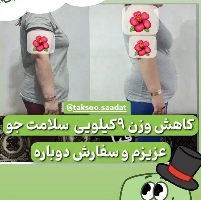 درمان لاغری آسان مثل کوره چربی بسوزنید|آرایشی، بهداشتی، درمانی|گنبد کاووس, |دیوار