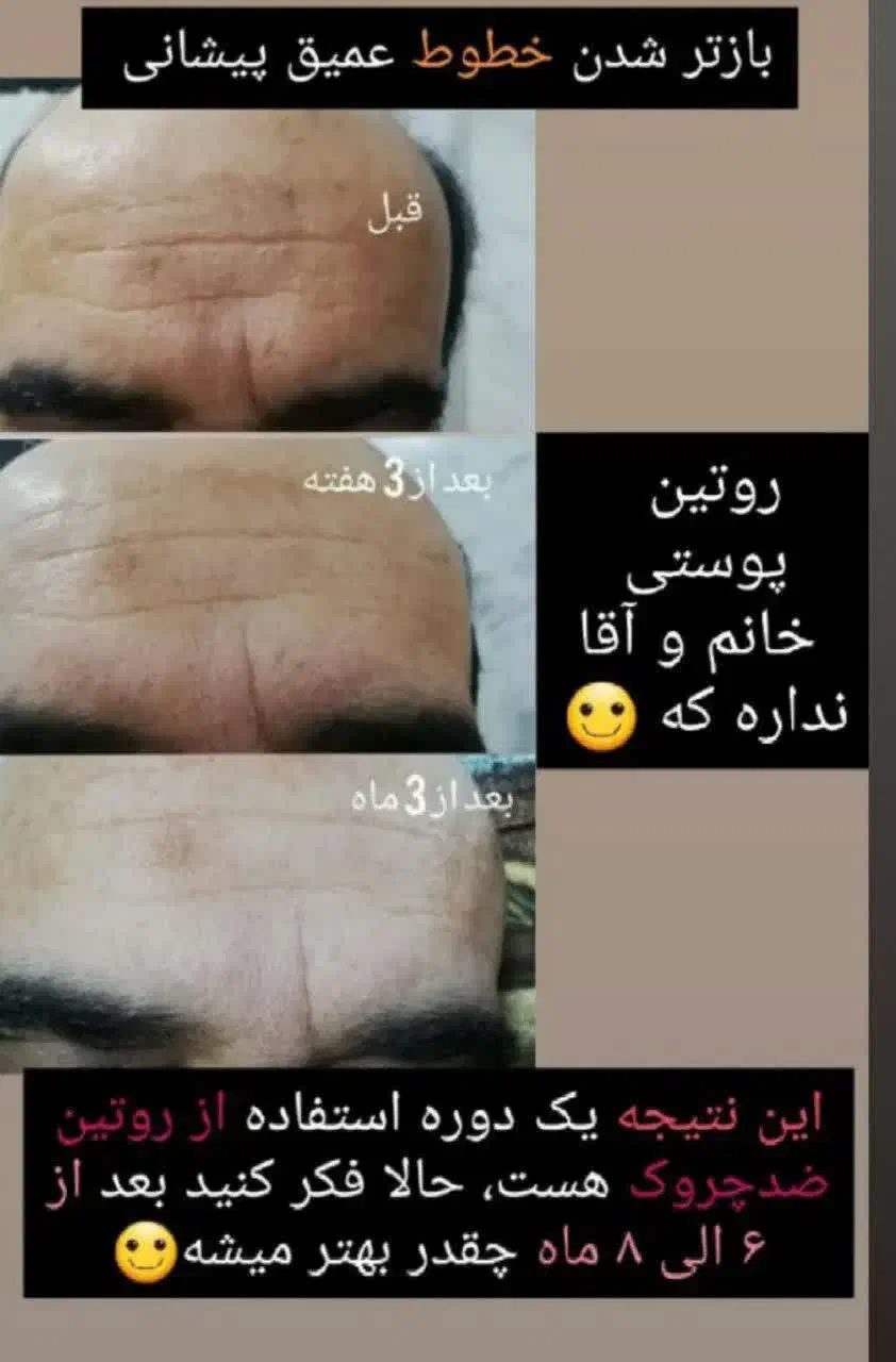 زیبایی و سلامتی پوست ومو|آرایشی، بهداشتی، درمانی|بابل, |دیوار