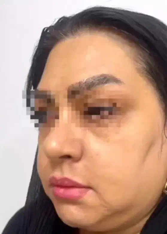 جشنواره لاغری 3تا12سانت در1جلسه وهایفوتراپی vip|خدمات آرایشگری و زیبایی|رشت, پارک شهر|دیوار