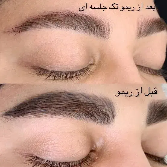 پاک کردن تاتوقدیمی ابرو دریک مرحله تضمینی با رجوی|خدمات آرایشگری و زیبایی|شوشتر, |دیوار