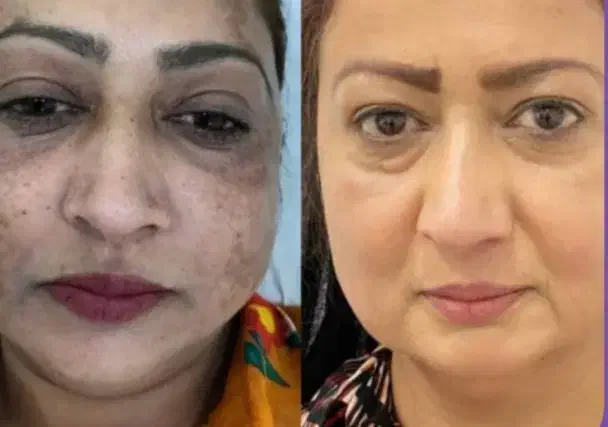 کرم معجزه شب|آرایشی، بهداشتی، درمانی|اردبیل, |دیوار