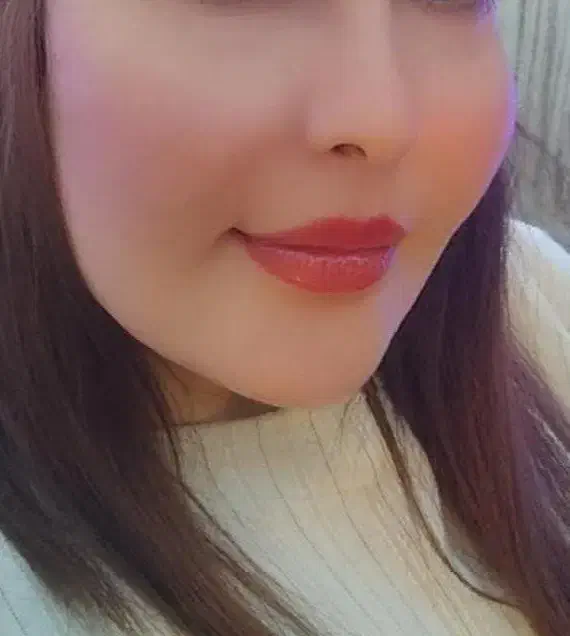 تزریق تخصصی فیلر،بوتاکس،مزو وآنزیم درمطب|خدمات آرایشگری و زیبایی|کرمانشاه, |دیوار