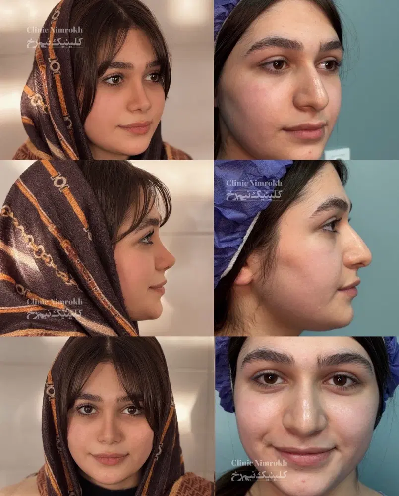 ویژه ترین جشنواره عمل بینی|خدمات زیبایی و سلامت|اصفهان, تیران|دیوار