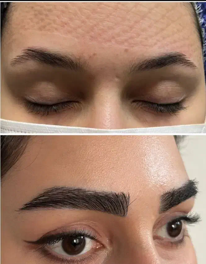 کاشت مو و ریش و ابرو|خدمات آرایشگری و زیبایی|یاسوج, |دیوار