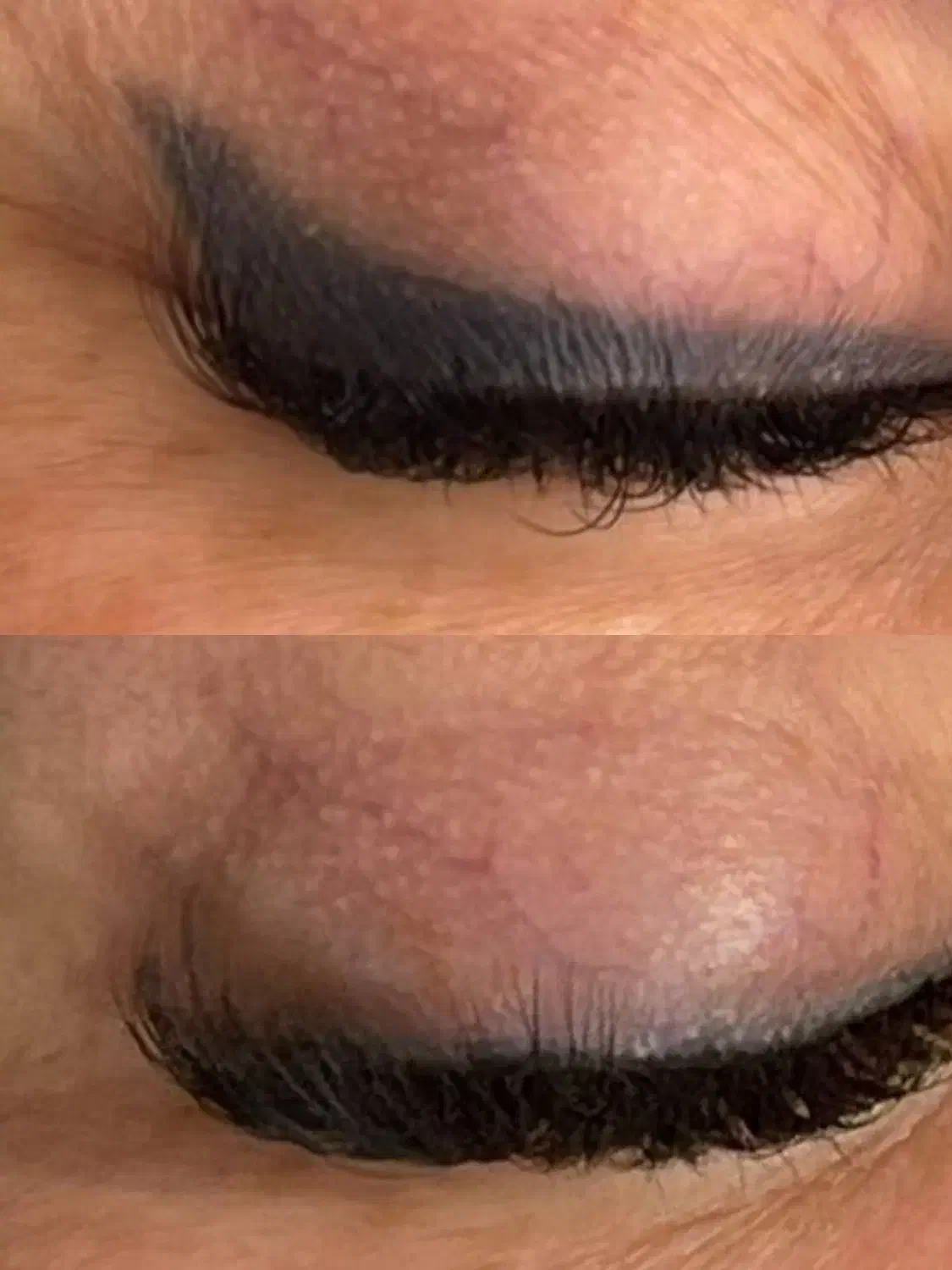 ریموو تتو های قدیمی|خدمات آرایشگری و زیبایی|بم, |دیوار