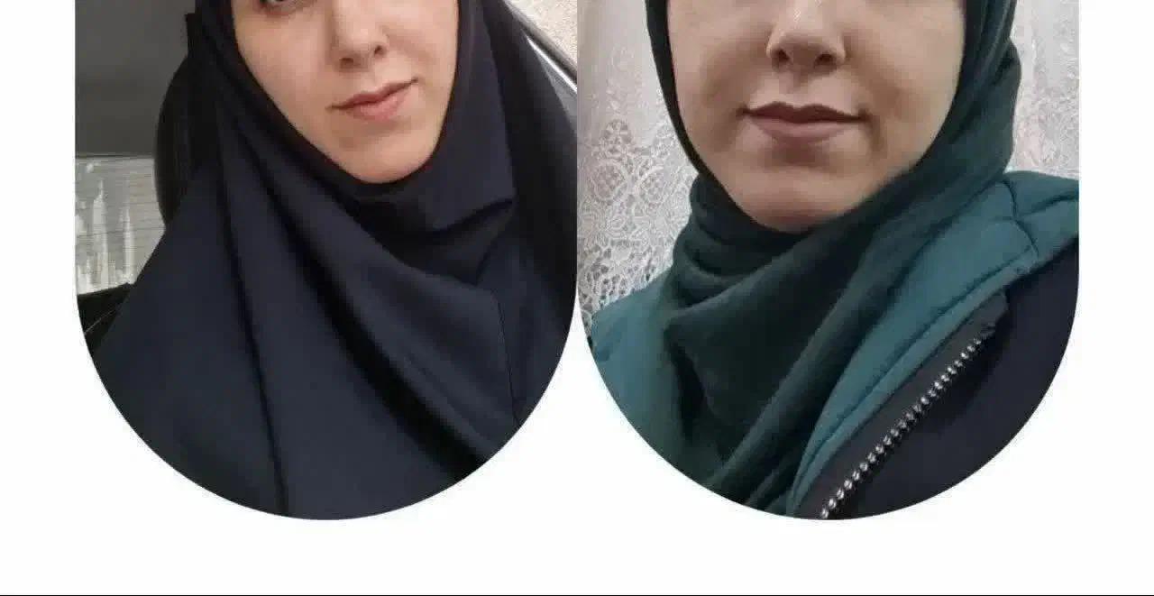 چاقی صورت و بدن تناسب اندام بامحصولات ورزش|تجهیزات ورزشی|خلخال, |دیوار