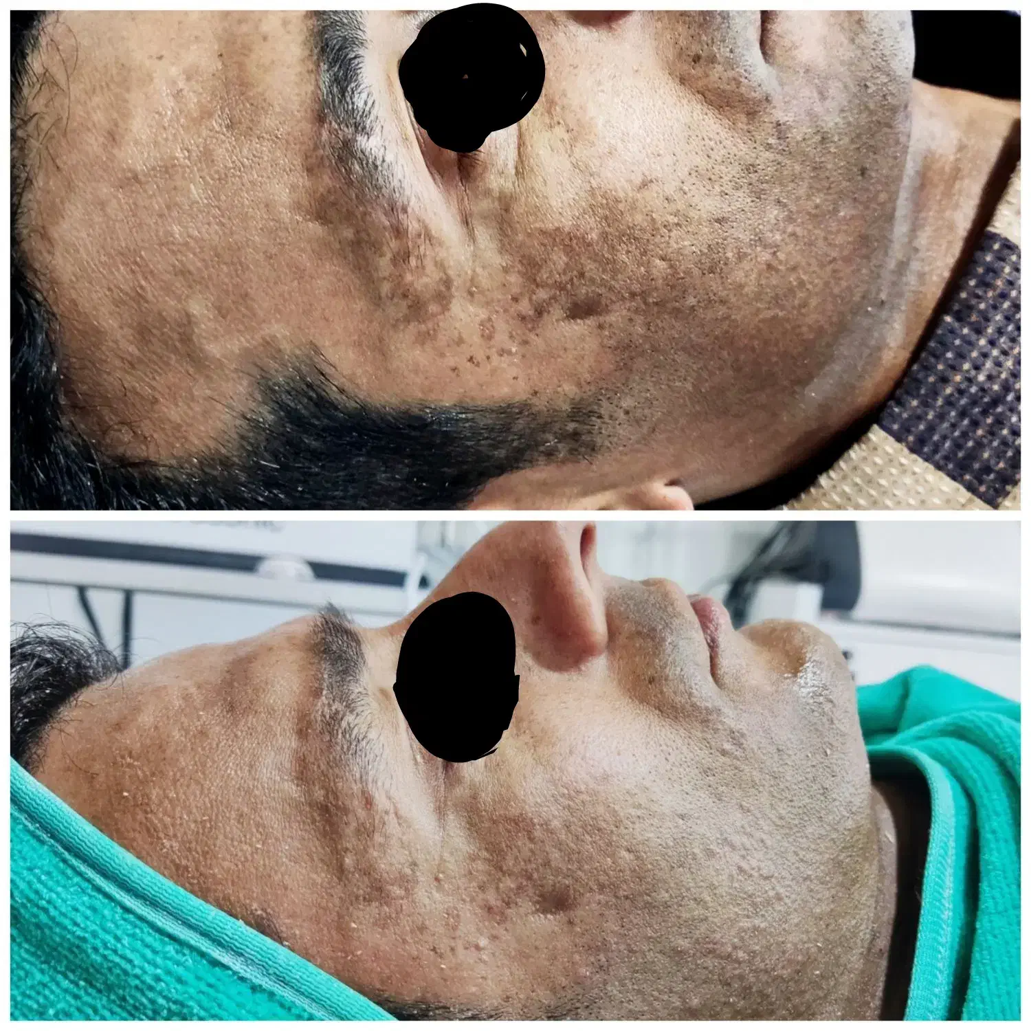 رفع تیرگی بدن/ روشن کننده بدن /زیربغل/بیکینی/صورت|خدمات آرایشگری و زیبایی|اهواز, سپیدار|دیوار