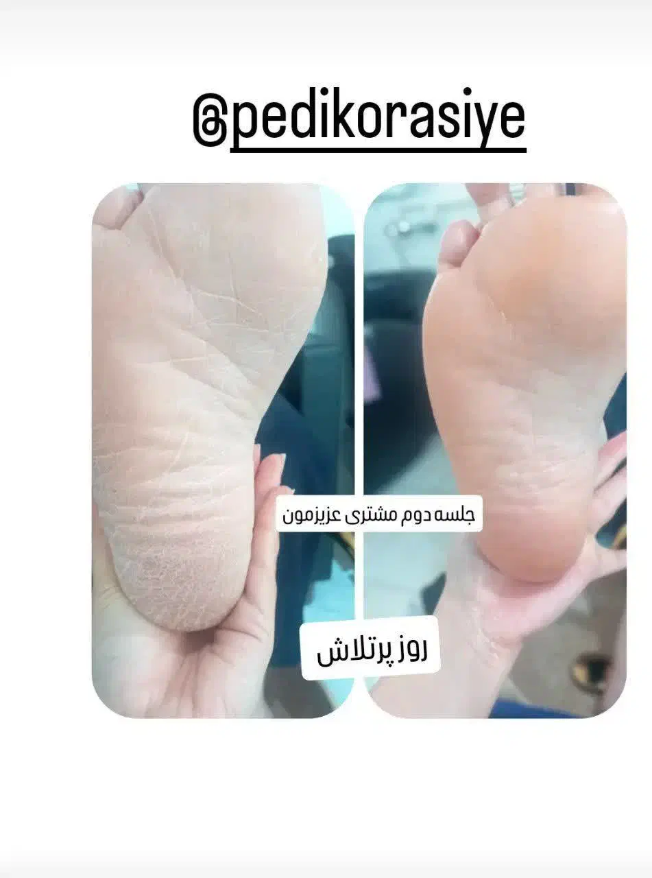 تخفیف ویژه یلدا روز زن|خدمات آرایشگری و زیبایی|قم, آزادگان|دیوار