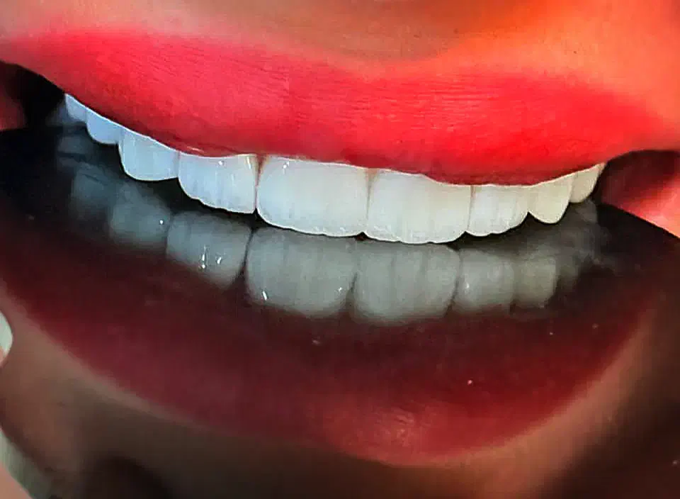 جرمگیری و کامپوزیت|خدمات آرایشگری و زیبایی|تهران, شهرک پرواز|دیوار