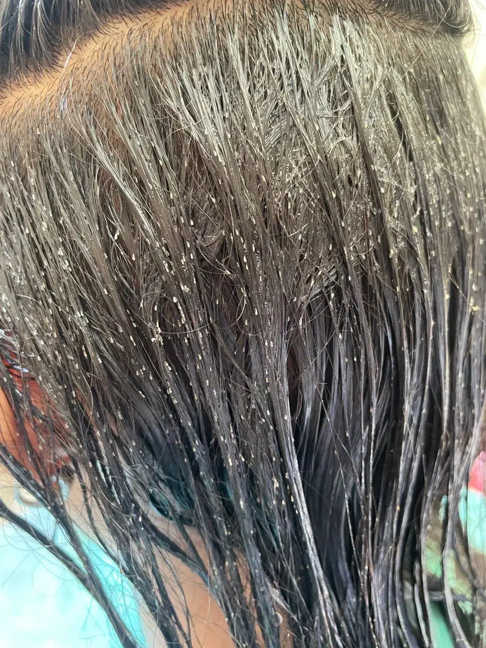 درمان قطعی رشک و شپش باکمترین هزینه|خدمات آرایشگری و زیبایی|اسلامشهر, شهرک قائمیه|دیوار