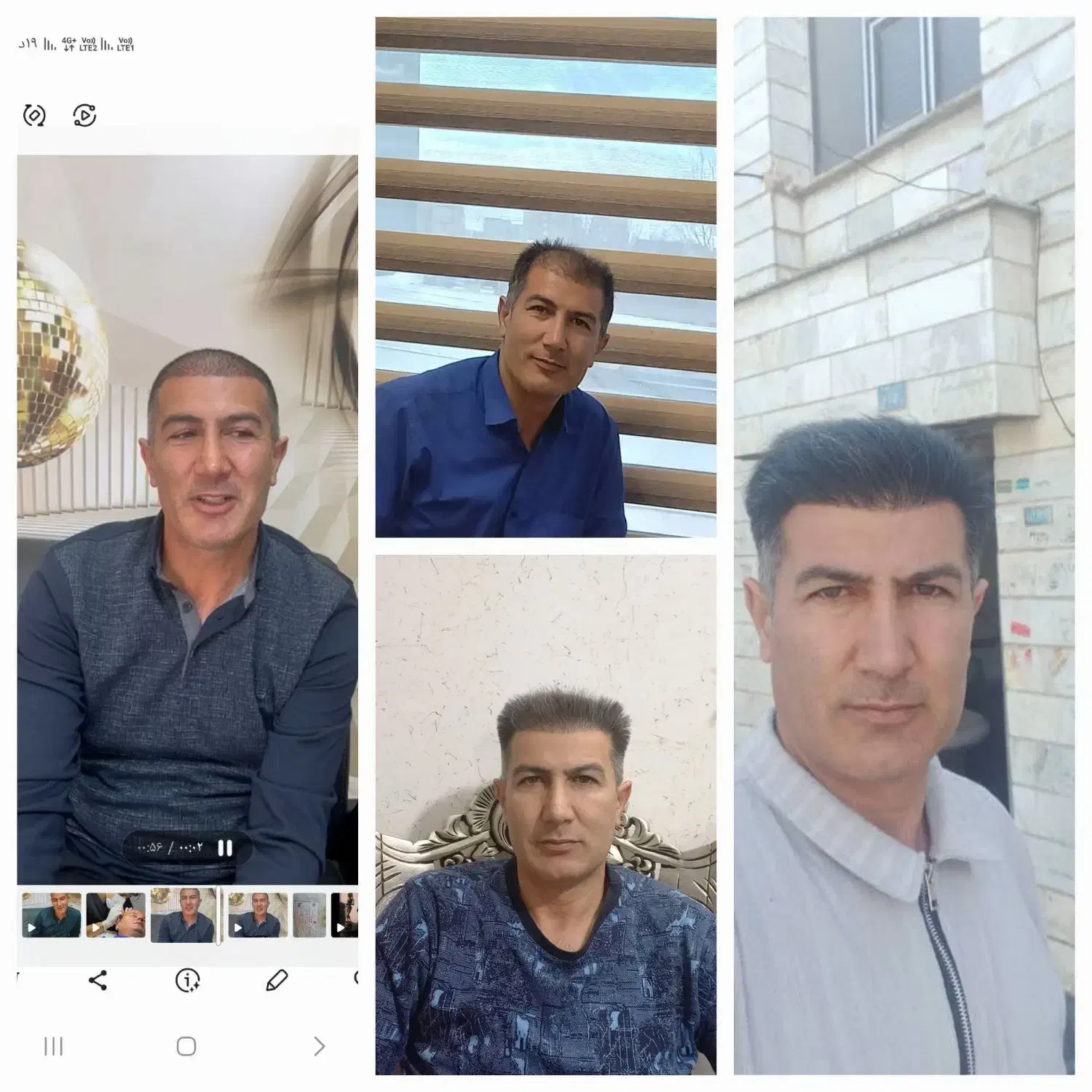 کلینک تخصصی پوست مو تبریز|خدمات آرایشگری و زیبایی|ماکو, |دیوار