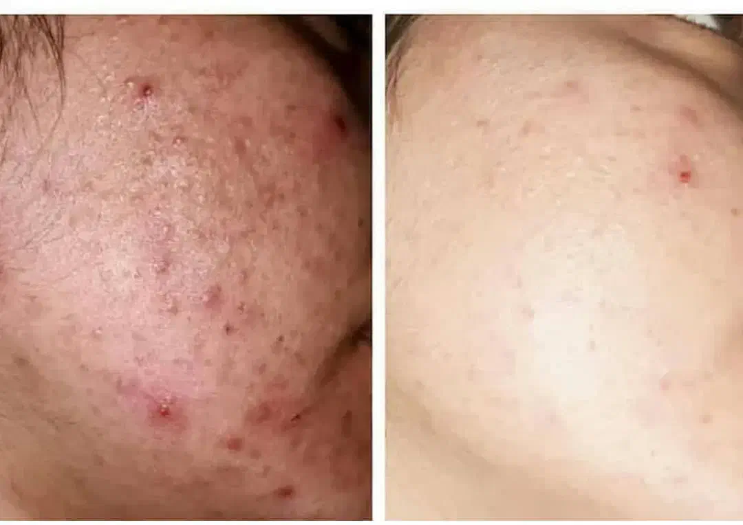 کرم معجزه شب اصل رفع لک وجوش وسفیدشدن پوست|آرایشی، بهداشتی، درمانی|قم, چهار مردان|دیوار