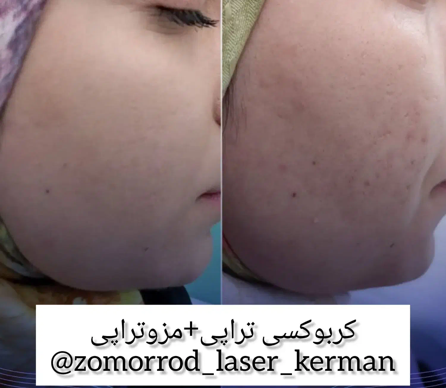 کلینیک پوست،مو،لیزر،لاغری و کربوکسی تراپی|خدمات آرایشگری و زیبایی|کرمان, |دیوار