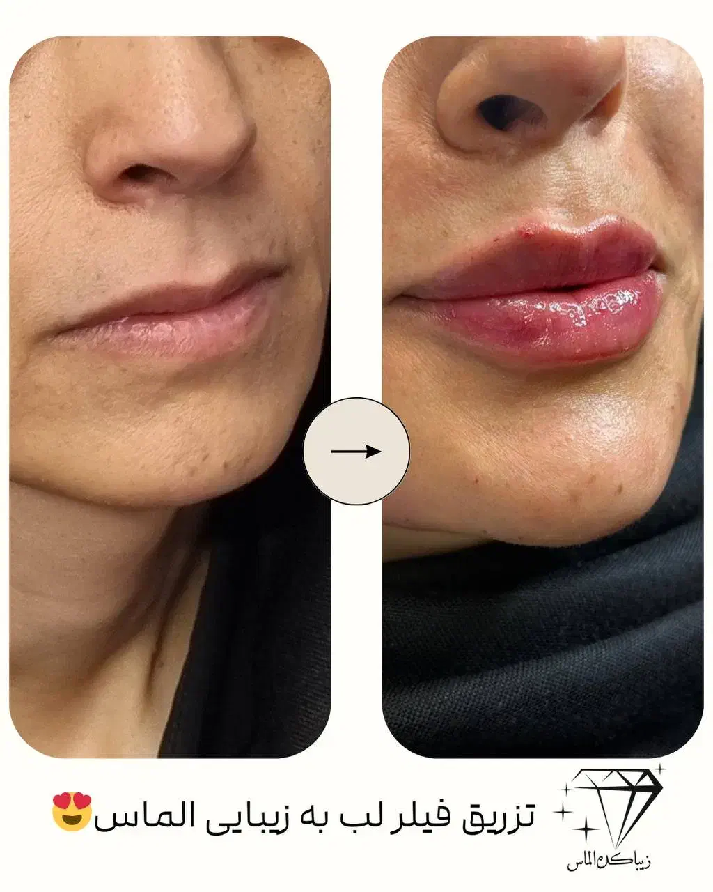 ارائه انواع خدمات زیبای درمطب توسط پزشک|خدمات آرایشگری و زیبایی|قم, امامزاده ابراهیم|دیوار