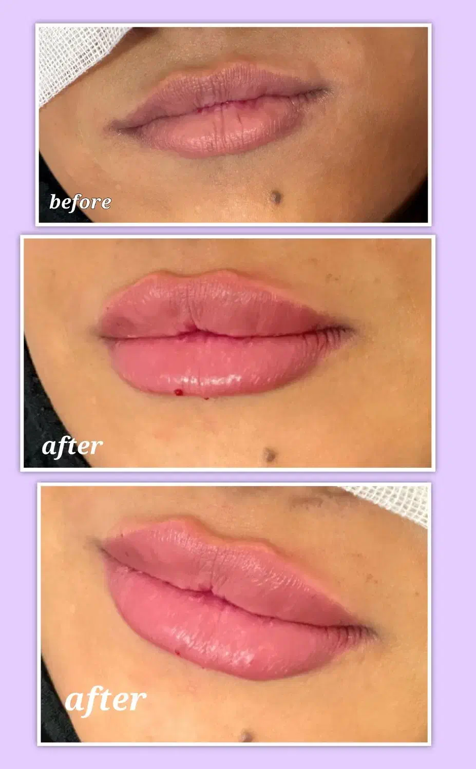 جشنواره پاییزی زیبایی در کلینیک ما آغاز شد...|خدمات آرایشگری و زیبایی|زاهدان, |دیوار