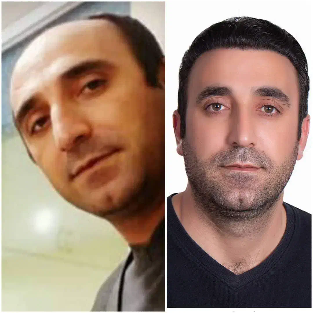 کاشتموپرتراکم برای اهل مراغه با اقساط وهتل رایگان|خدمات آرایشگری و زیبایی|مراغه, |دیوار