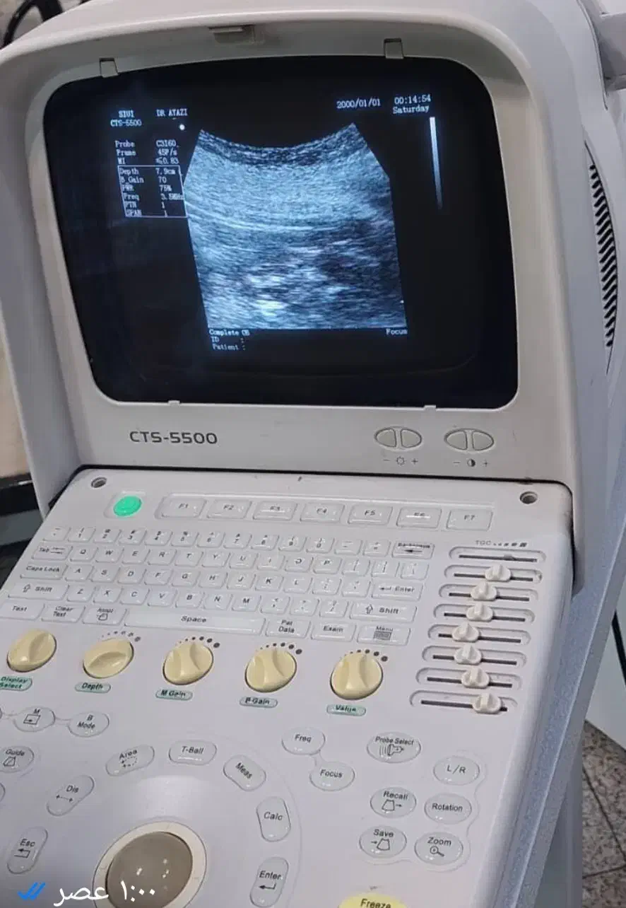 دستگاه سونوگرافی ۵۵۰۰سویی|آرایشی، بهداشتی، درمانی|تهران, باغ فیض|دیوار
