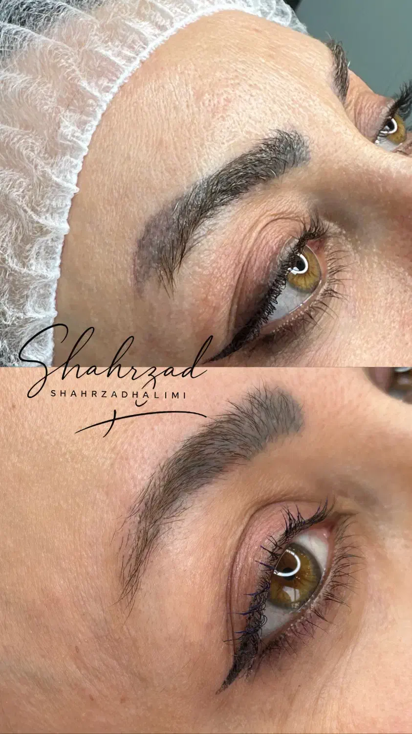 اجاره ورنت لیزر کیوسوییچپیکوشور بااپراتور حرفه ای|پزشکی|تهران, اقدسیه|دیوار