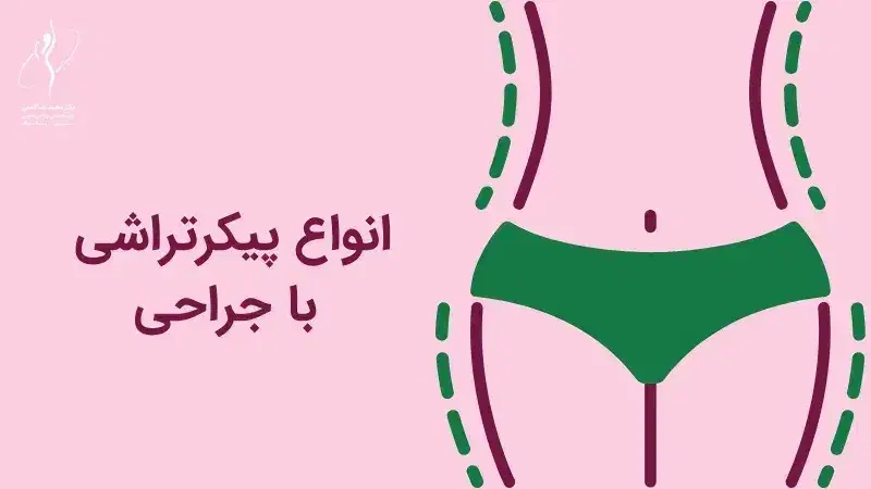 جشنواره ویژه پیکرتراشی، لیپو، ابدو، زیبایی بدن|خدمات آرایشگری و زیبایی|شاهین‌شهر, مخابرات (شهید بهشتی)|دیوار