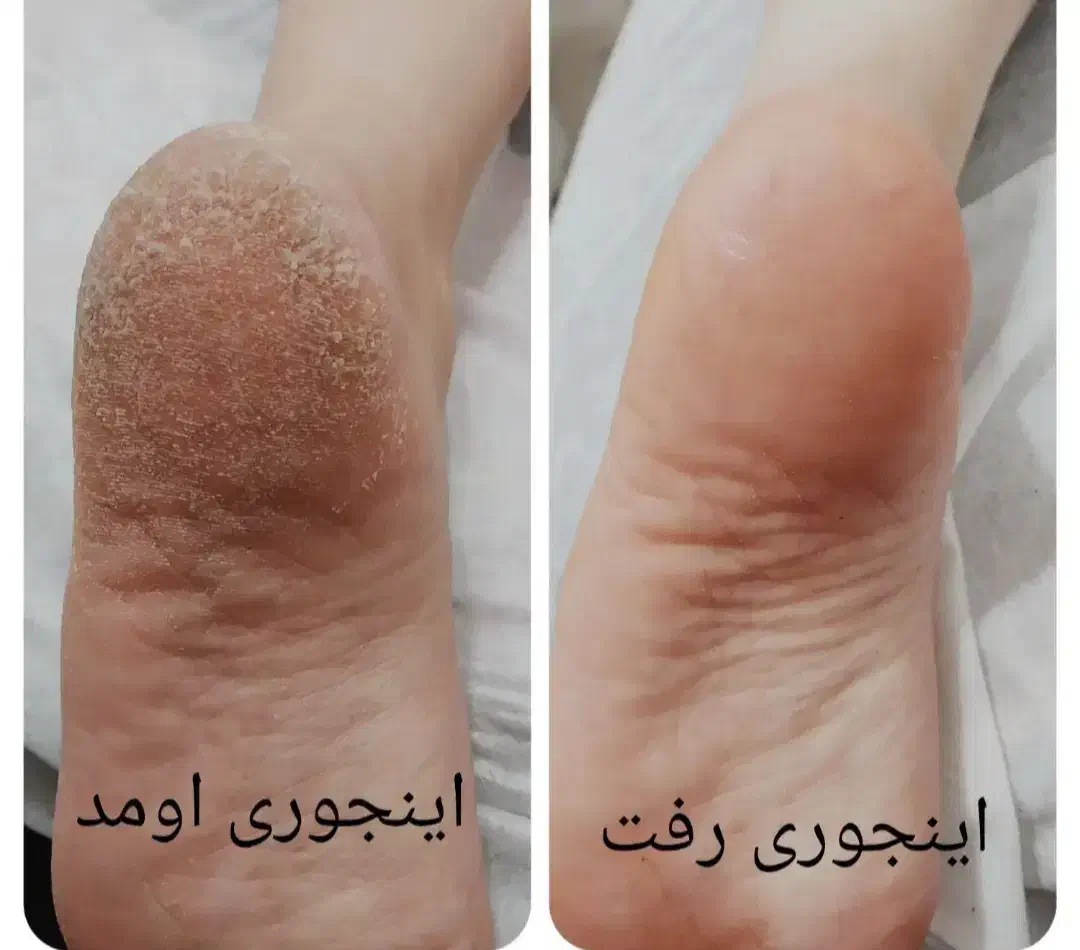 آموزش پدیکوربا نکات طلایی تخفیف ویژه|خدمات آرایشگری و زیبایی|اصفهان, گلزار|دیوار
