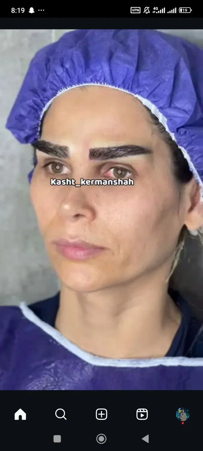 کاشت ابرو تضمینی با خواب طبیعی و آموزش|خدمات آرایشگری و زیبایی|کرمانشاه, |دیوار