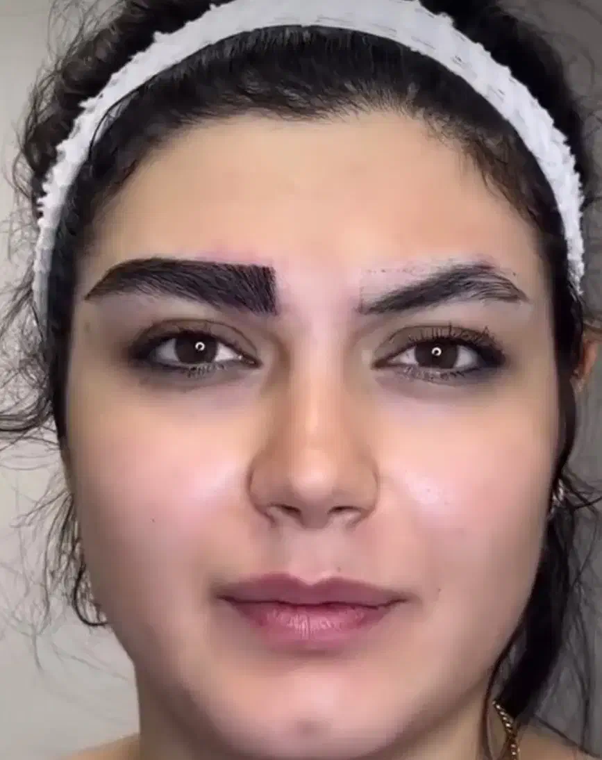 کاشت مو وابرو بدون سیخ سیخ شدن وبهترین خواب|خدمات آرایشگری و زیبایی|مشهد, احمدآباد|دیوار