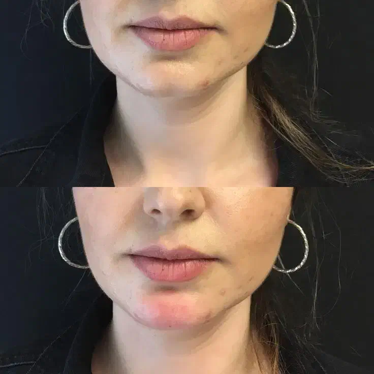 کلینیک زیبایی جراحی ژل بوتاکس غبغب فیلر لیزر مزو|خدمات آرایشگری و زیبایی|کرج, مهرویلا جنوبی|دیوار