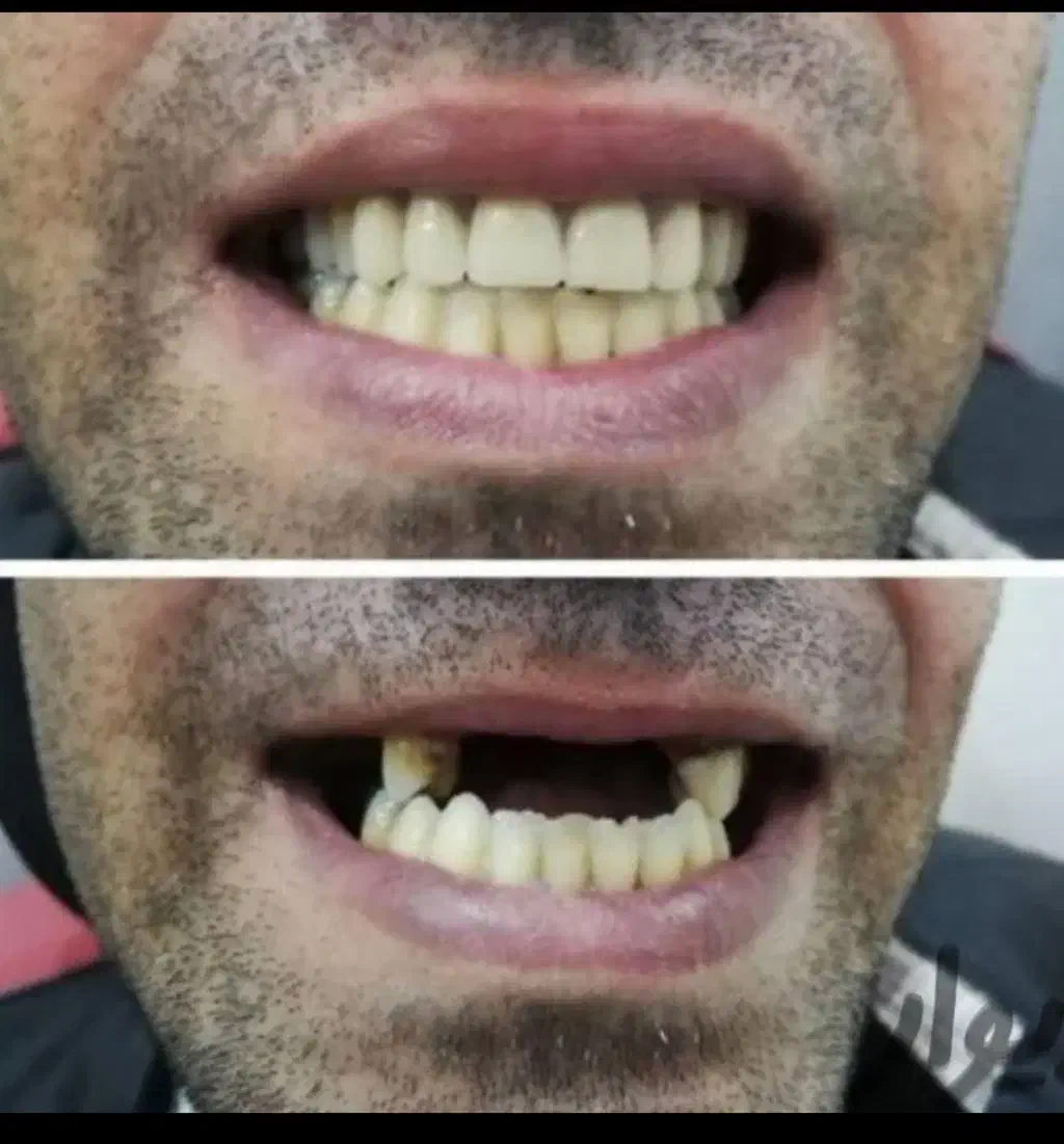 دندانسازی ایده آل|خدمات آرایشگری و زیبایی|لاهیجان, گلستان|دیوار