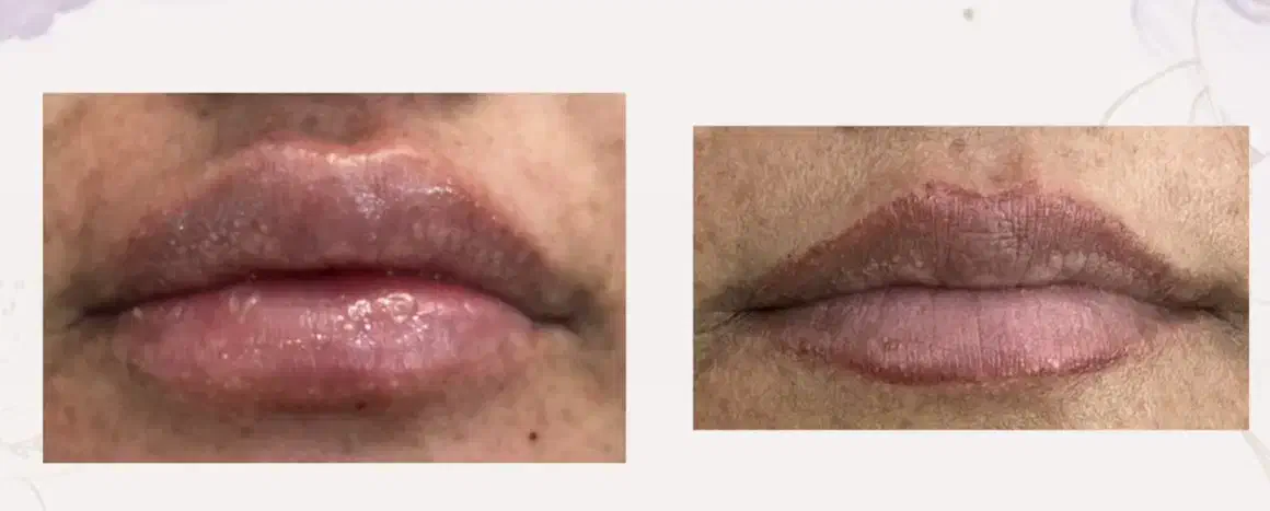مدل فیلر صورت در کلینیک نوا|خدمات آرایشگری و زیبایی|شیراز, ستارخان|دیوار